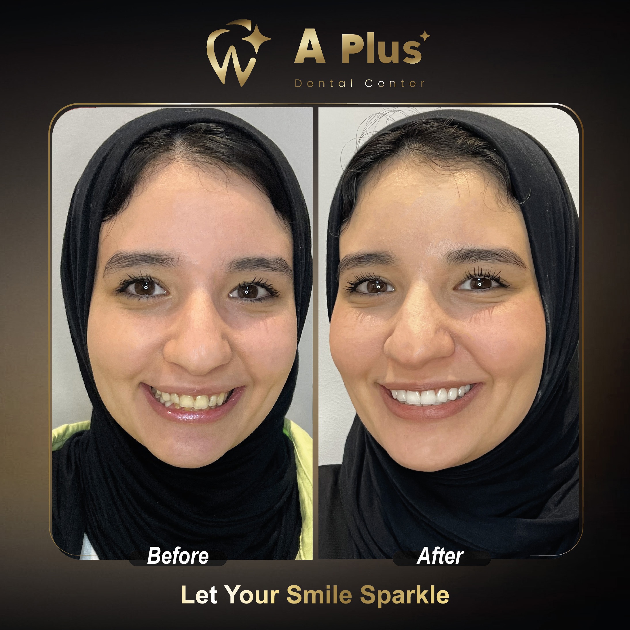 إعادة تأهيل وتجميل الأسنان وتناسق الابتسامة